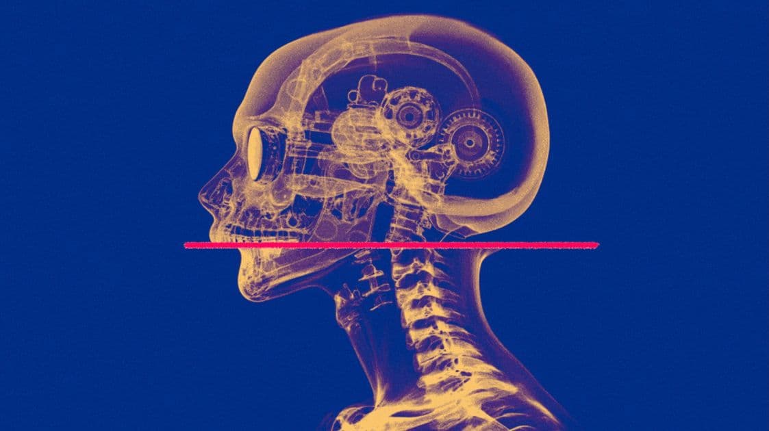 X-ray of a robot skull